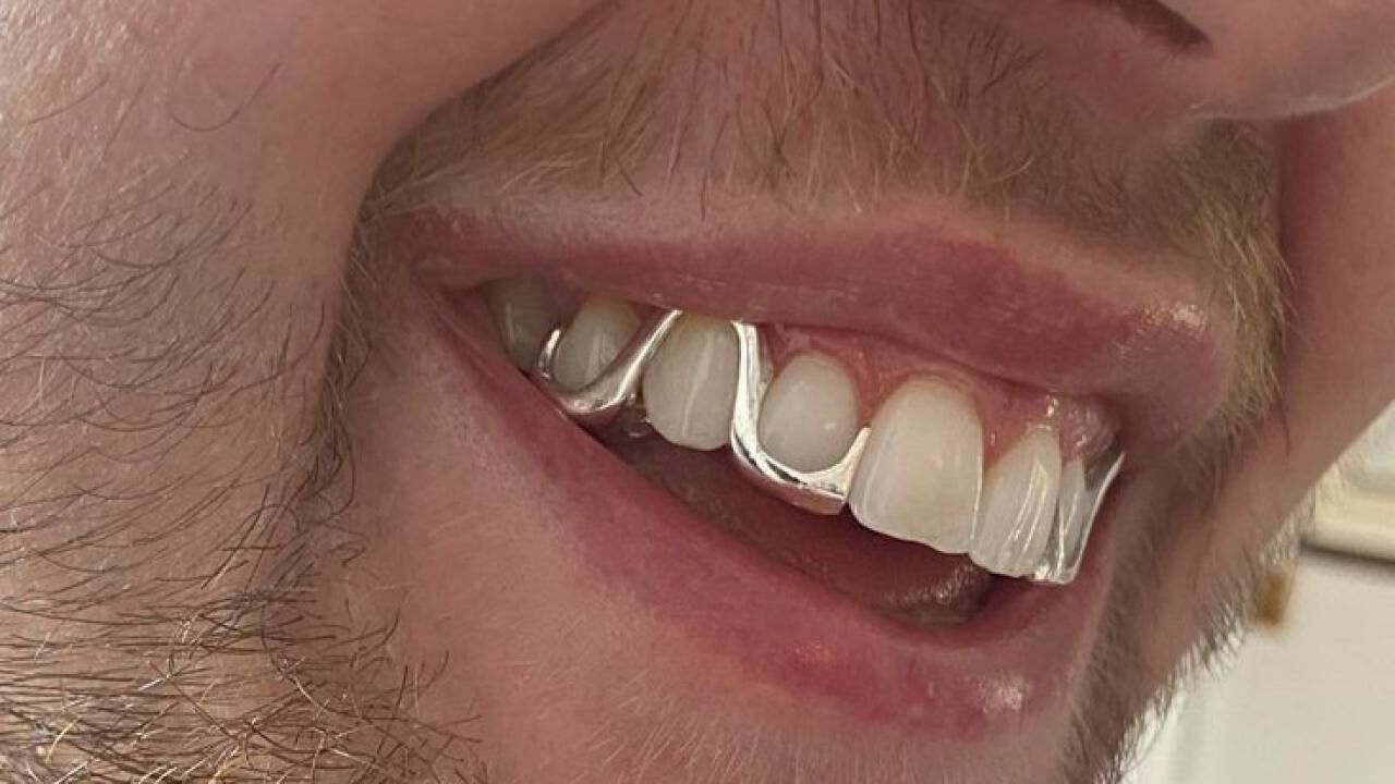 Erkek estetiğinde yeni trend: "Grillz" yükselişte