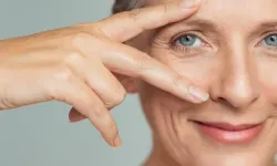 Kaz Ayağı Nedir? Kaz Ayağından Kurtulmanın Yolları Nelerdir? Kaz Ayağı Çizgilerinden Kurtulma Yolları