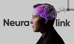 Elon Musk'ın beyin çipi projesinde çığır açan gelişme!