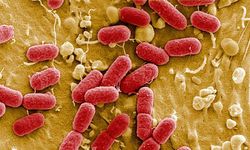 Klebsiella pneumoniae hipervirülan nedir, Türkiye'de var mı?
