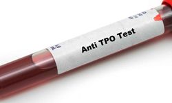 Anti TPO nedir? Anti-TPO yüksek olursa ne olur?