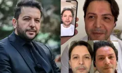Nihat Doğan estetikle bambaşka birine dönüştü: Sosyal medyanın diline düştü!
