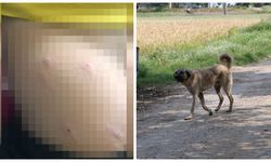 Sahipsiz köpek, 5 yaşındaki çocuğa saldırdı