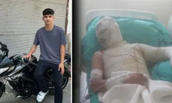 16 yaşındaki lisanslı futbolcu olan yeğenini yaktı; suçu kardeşine attı!