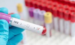 İzmir'de anonim ve ücretsiz HIV testi dönemi başladı
