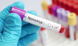 Salgın yükselişe geçti, uzmanlar hijyen konusunda uyarıyor: ‘Norovirüs, çocuk ve yaşlılar için büyük risk’