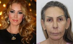 Petek Dinçöz’ün annesi estetik yaptırdı!