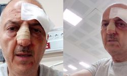 Boşanma sürecindeki tartışmalı ev tahliyesinde korkunç saldırı: Burnu kırıldı!