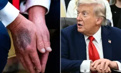 ABD Başkanı Donald Trump öldü mü haberleri gerçeği yansıtıyor mu?
