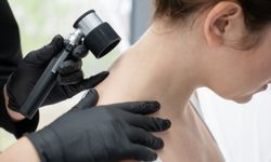 Cildinizdeki her değişiklik size mesaj veriyor olabilir: Cilt check-up’ınızı ertelemeyin!