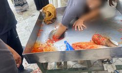 16 yaşındaki kız çocuğu elini salça makinesine kaptırdı