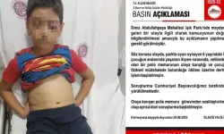 Oğluyla tartışan çocuğa fiziksel müdahale eden polis, görevden uzaklaştırıldı