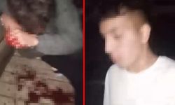 Kız meselesi yüzünden tartıştığı kişiyi darbeden şüpheli tutuklandı