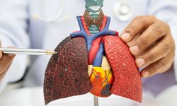 Düşük doz BT ile akciğer kanserinde erken tanı mümkün