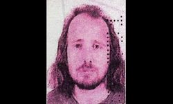 Estetik operasyon için Türkiye'ye gelen İngiliz vatandaşı hayatını kaybetti