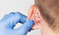 Kepçe kulak sorunu, çocukların psikolojisini olumsuz etkiliyor