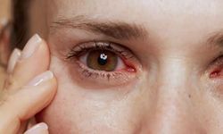 Kış aylarında göz kuruluğu ve enfeksiyonları artıyor