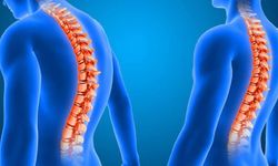 Skolyozda erken tanı uyarısı: Ergenlikte hızla ilerliyor