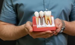 1 aylık maaş, 1 diş etmiyor