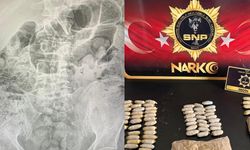 Midelerine gizlediler, ameliyatla çıkarıldı: Yasaklı madde operasyonunda 4 tutuklama!