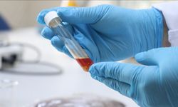 Üzüm posasından tek hücre yağı üretildi