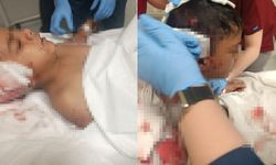 Okul yolunda korku dolu anlar: Başıboş köpek 8 yaşındaki çocuğa saldırdı!