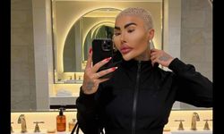 Kim Kardashian’a benzemek için estetik yaptırmıştı: Jordan James Parke hayatını kaybetti