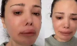 Yüz nakli yaptırmıştı: Didem Ceran hastalığı ne, Didem Ceran sağlık durumu nasıl?
