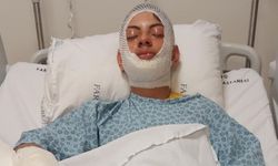 Isınmak isterken canından oluyordu! Ateşe benzin döken genç yaralandı