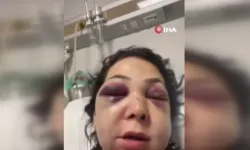 Kafede dehşet: Anne oğlunun gözü önünde darp edildi