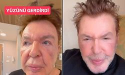 Kuşum Aydın'ın yüzüne ne oldu? Kuşum Aydın'ın sağlık durumu nasıl?