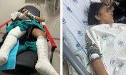 “Polis” kılığında maskeli saldırı: Anne ve oğlu yaralandı