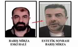 Estetikle yüzünü değiştiren firari Barış Mirza kimdir? Barış Mirza-Burak Şen olayı ne?