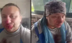 Şarkıcı Onur Akay'a ne oldu? Onur Akay sağlık durumu nasıl?