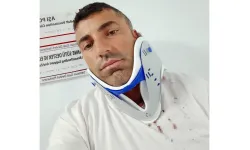 Pusu kurup beyzbol sopalarıyla saldırdılar!