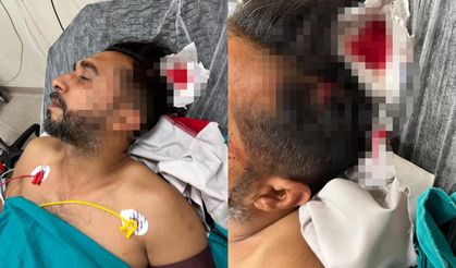 Ölümden döndü: Sipariş hazırlarken başına mermi isabet etti!