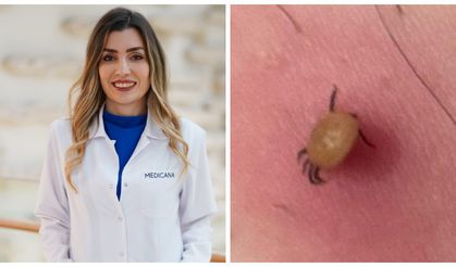 Sessiz tehdit: Kene ısırığı belirtisiz başlayıp hayati risk yaratabilir