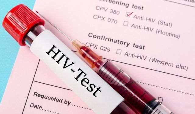 HIV pozitif olduğunu eşinden gizleyen sanık hakkında flaş karar: 20 yıl hapsi isteniyor!