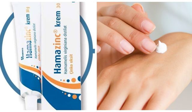 Hamazinc krem ne işe yarar, ne için kullanılır ve kaşıntıya iyi gelir mi?