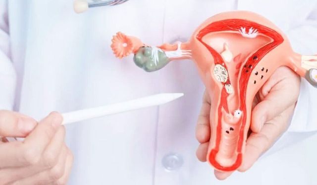 Uzmanlar uyarıyor: Polikistik Over Sendromu sadece bir kadın hastalığı değil