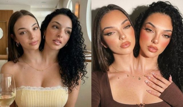 Yapışık ikizler Valeria & Camila gerçek mi, yapay zeka mı?