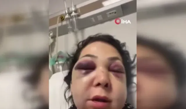 Kafede dehşet: Anne oğlunun gözü önünde darp edildi