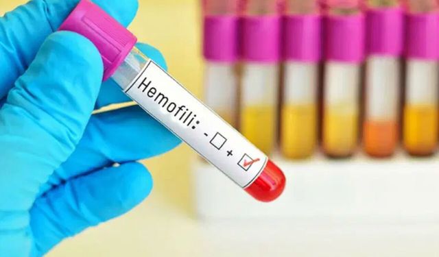 Uzmandan 'hemofili' açıklaması: Erken tanı ve bilinç hayat kurtarıyor