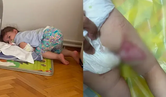 İzmir'de restoranda üzerine kızgın yağ dökülen bebek yandı
