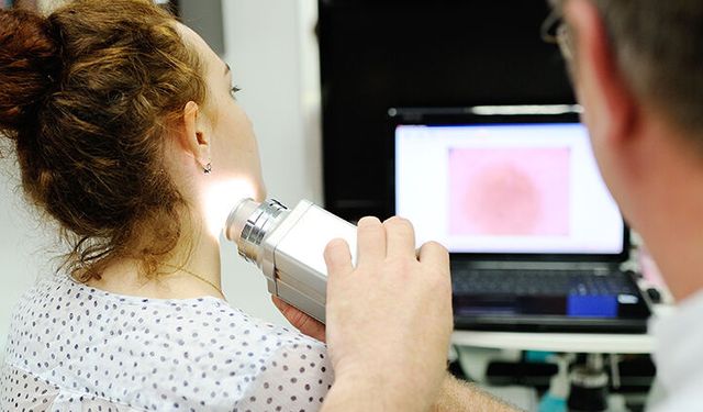 DİJİTAL DERMATOSKOP SİSTEMİ SATIN ALINACAK