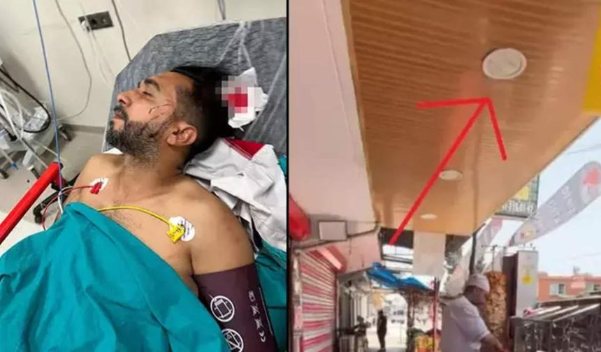 Döner yerken başından vuruldu