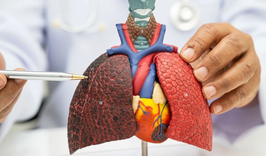 Düşük doz BT ile akciğer kanserinde erken tanı mümkün