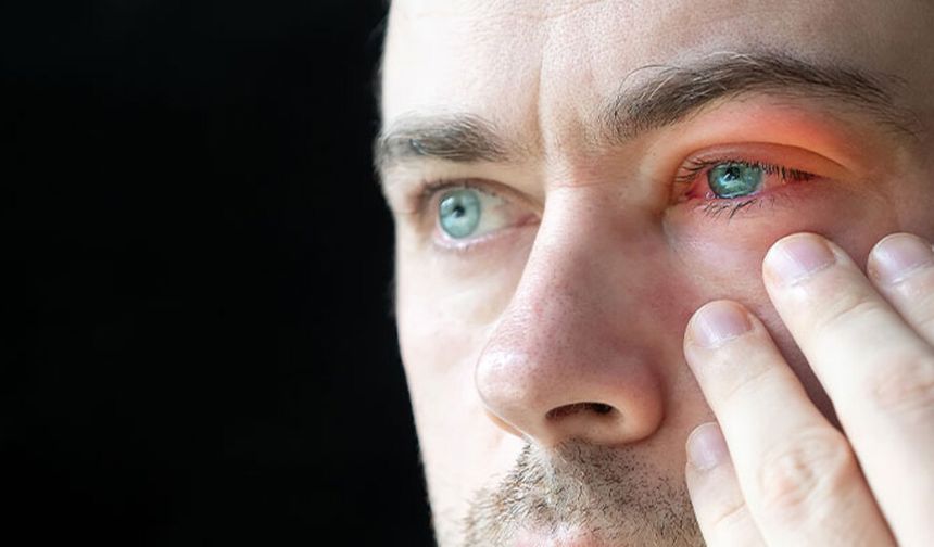 Kış aylarında göz sağlığına dikkat: Kuruluk, enfeksiyon ve ışık uyarısı