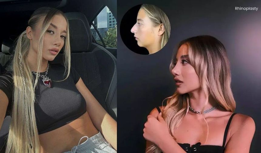 Burun estetiği olan Aleyna Kalaycıoğlu’nun değişimi sosyal medyayı salladı!