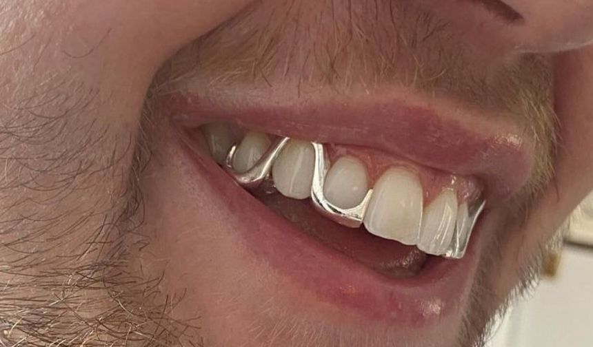 Erkek estetiğinde yeni trend: "Grillz" yükselişte